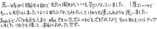 エイジング